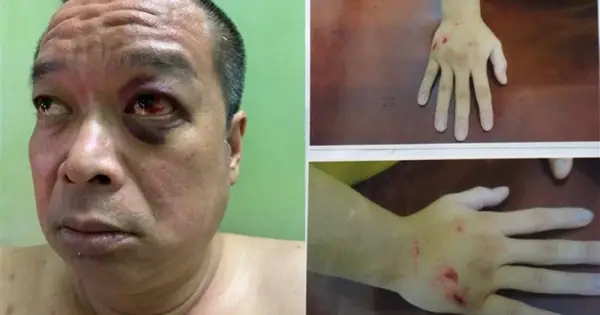 Chung Cư 86 Nguyễn Thông: Đánh Giá Chi Tiết Ưu Nhược Điểm Và Trải Nghiệm Thực Tế