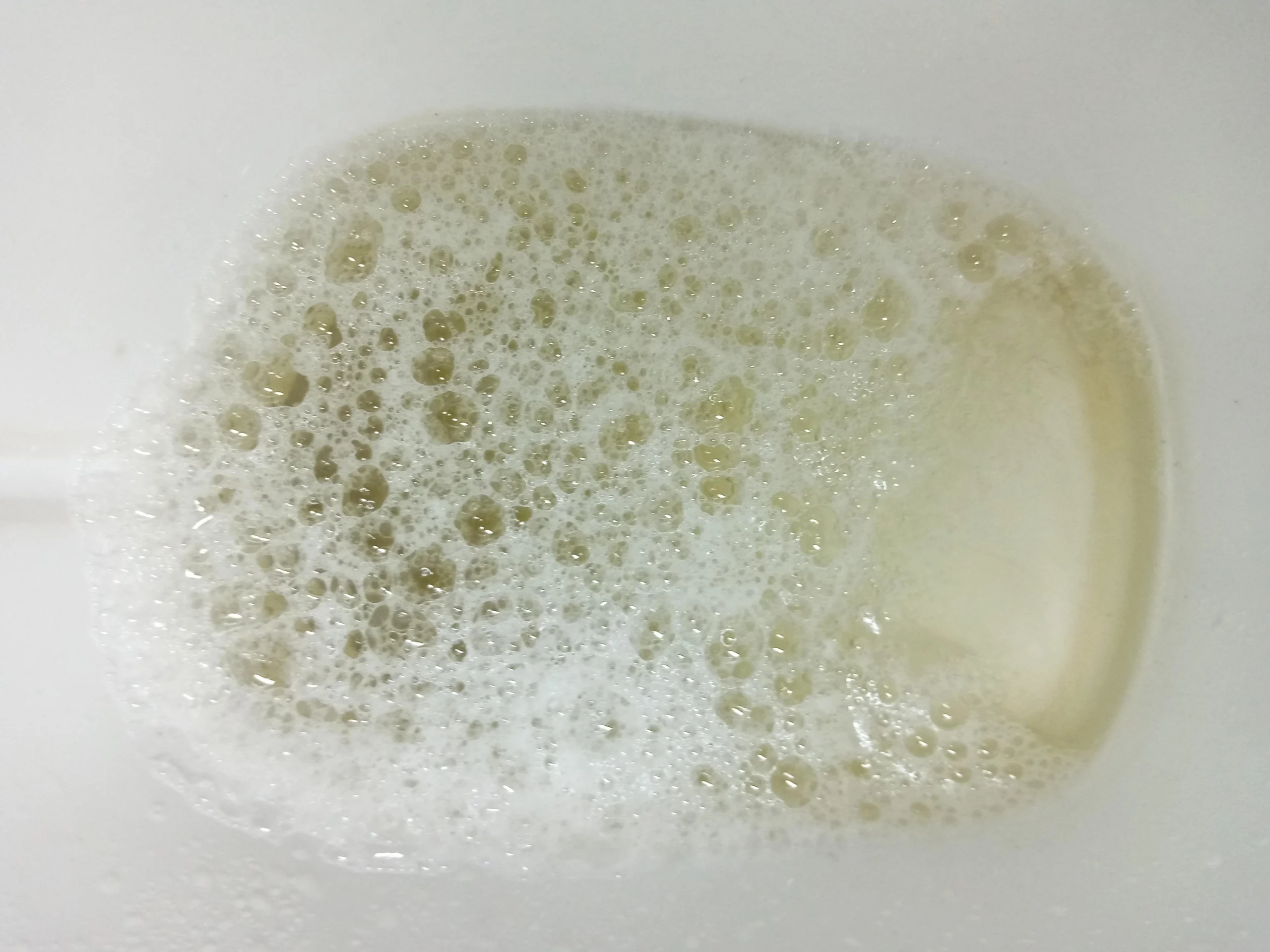 Chăm sóc sức khỏe thận hàng ngày