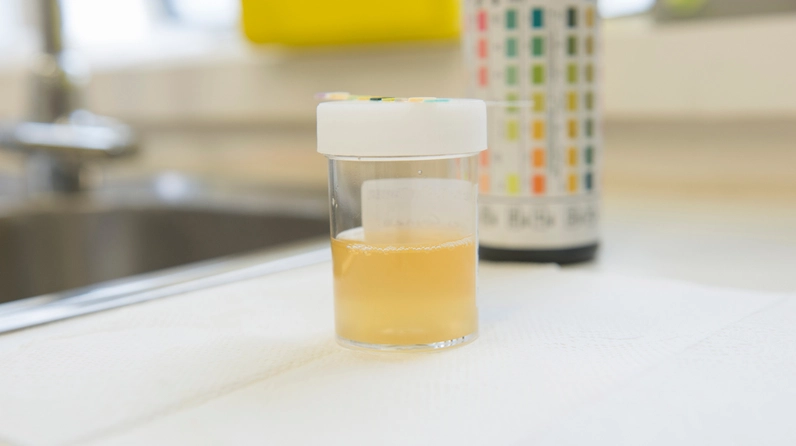 lay-nuoc-tieu-xet-nghiem-luc-nao-la-tot-nhat-huong-dan-chi-t_114